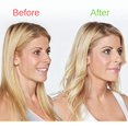 thumbnail image 1 of Prevage MD Anti-Aging Skin Care Treatment, 1 of 3
