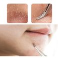 thumbnail image 5 of Acne Blemish Blackhead Comedone Stainless Steel Blemish Extractor Tool for Remove Blackhead Acne Whitehead Pimple Bend Curved Tweezer, 5 of 8