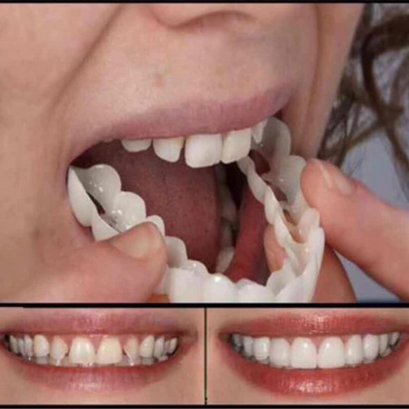 False Teeth Veneer Silicone Top Bottom Veneers Temporary Cosmetic Upper Lower Denture Fake Tooth Cover