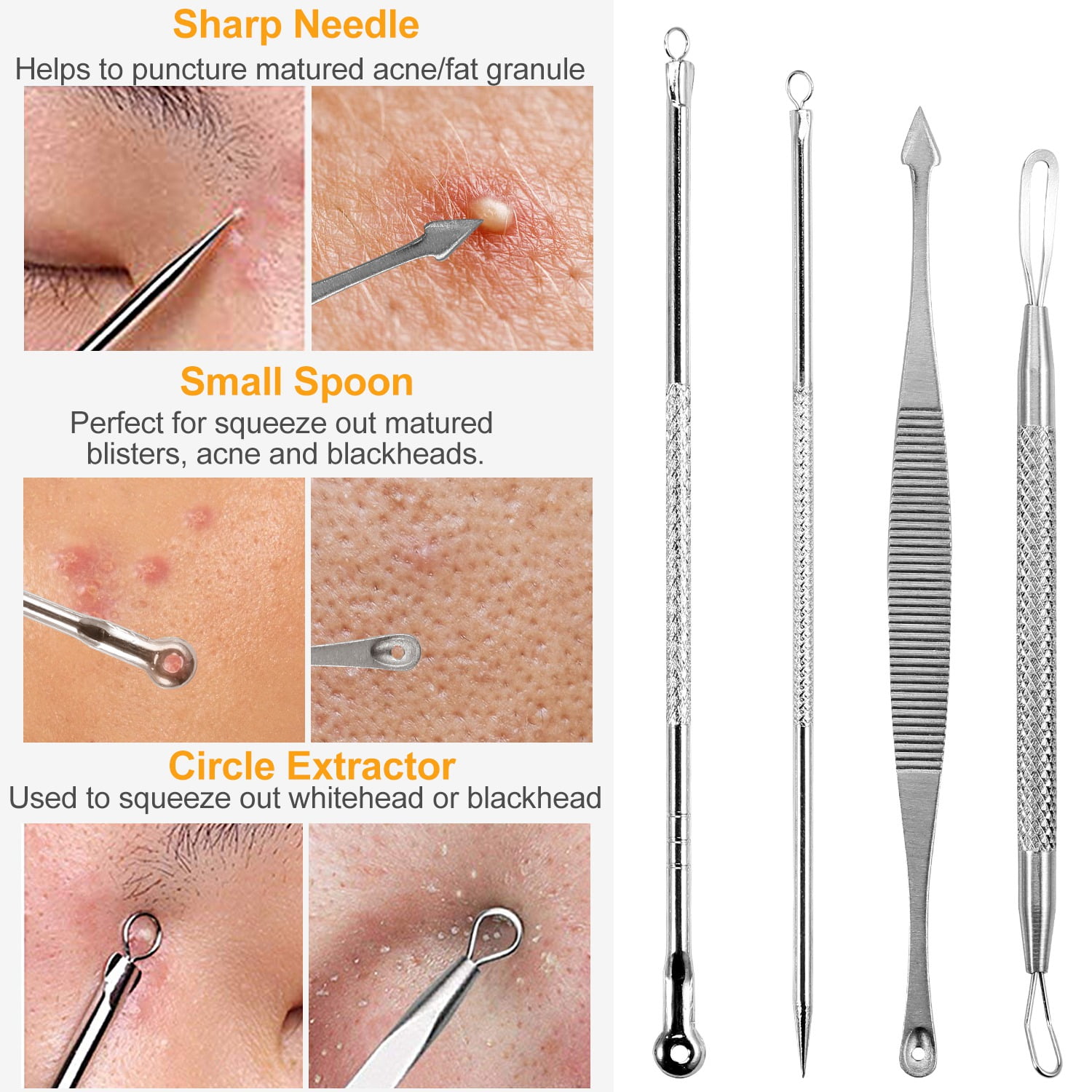 Videos Of Popping Pimples And Blackheads 41 - 2qghlu0