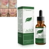 Eychin Tea Tree Oil Moisturizing Tea Tree Essential Oil for Blemished Skin Anti-pimples Warts