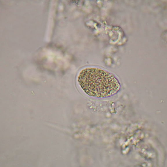 Necator Americanus Eggs Slide, W.M.
