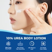 OUKEYA 10% Urea Cream Body Lotion Softens & Soothes Dry Chapped Skin, Face Elbow Lotion 11.28 oz