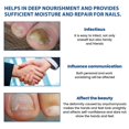 thumbnail image 4 of XIMONTH XIB05-A006-32-BU1 32Pcs Fungal Nail Patches Ingrown Toenail Overnight Repair Treatment, 4 of 5