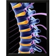 thumbnail image 2 of Spine And Spinal Nerves,computer Artwork, Framed Art Print Wall Art by PASIEKA Sold by Art.Com, 2 of 5
