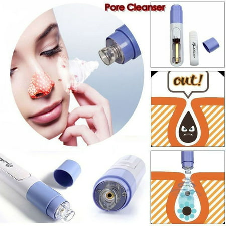 Walfront Electric Blackhead Remover Spot Cleaner Acne Vacuum Cleansing Machine blackhead Suction Tool,A Clean Face Without