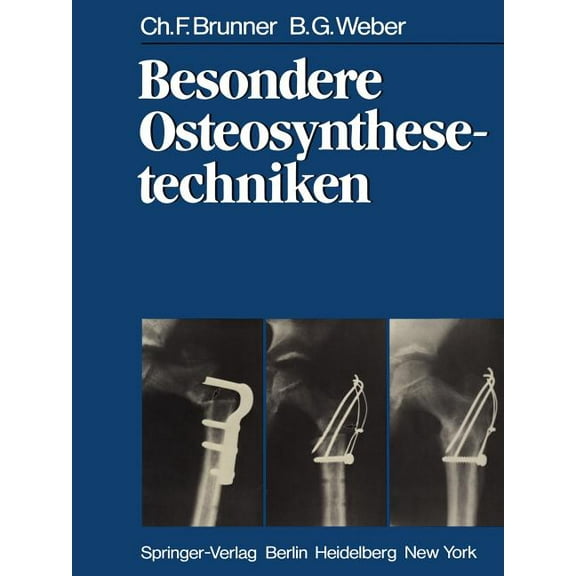 Besondere Osteosynthesetechniken, (Paperback)