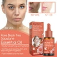 IIRich Rose Black Tea Squalane Repair Essence Oil,Collagen Boost Anti