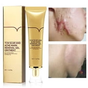 Acne Scar Removal Cream Stretch Marks Face Skin Cream Shrink Pores Gel-Fade Scar Marks Acne Cream Skin Care (Packaging Upgrade)