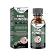 thumbnail image 1 of Extra Strong Nail Fungus Treatment, Best Nail Repair Stop Fungal Growth Effectiv Tw, 1 of 2