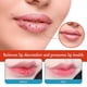 thumbnail image 3 of Bálsamo labial CHAO 20 g tratamiento de queilitis, 3 of 5