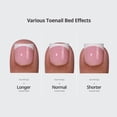 thumbnail image 4 of Tips para uñas de los pies BTartboxNails XCOAT TIPS para mujer, 150 unidades, 4 of 8