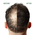 thumbnail image 6 of FIBR Hair Keratin Building Fibers, Fill In Fine and Thinning Hair for instant Full and Thick Look, Premium Hair Fibers For Both Men and Women (Blonde), 6 of 7