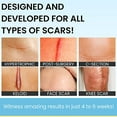 thumbnail image 3 of Scarguard - Invisible Brush-On Silicone Sheet with Vitamin E - Scar Removal for Keloids, Burn Scars, Surgery Scars, Stitches, Cuts - No Ugly Scar Sheets, Cream or Messy Scar Gel Needed, 3 of 3
