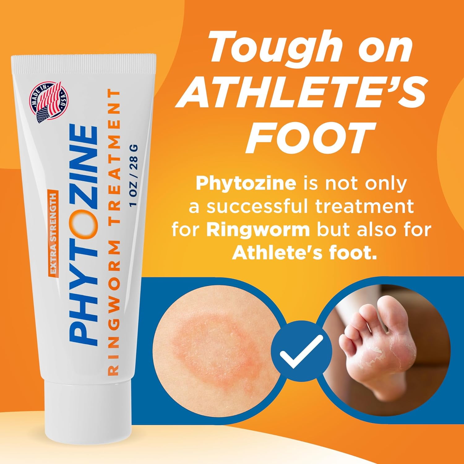 Phytozine Anti-Fungal Ringworm Medicine, Topical Treatment Cream