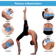 thumbnail image 4 of Juego de terapia de ventosas de silicona, juego de ventosas profesionales para estudio y hogar, tazas de terapia de masaje, kit de ventosas para reducción de celulitis, 4 of 5