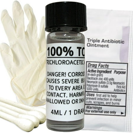 100% TCA Skin Peel Kit - Acid Peel - Scar Removing Face Peel For Tattoo Removal, Tags, Moles, Age Spots, Stretch Marks, Acne, Scars, Hyperpigmentation, Wrinkles & (Best Way To Fade Acne Scars Fast)