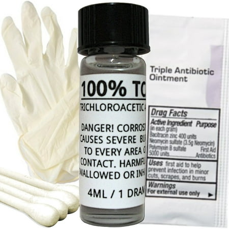 100% TCA Skin Peel Kit - Acid Peel - Scar Removing Face Peel For Tattoo Removal, Tags, Moles, Age Spots, Stretch Marks, Acne, Scars, Hyperpigmentation, Wrinkles & (Best Way To Fade Acne Scars)