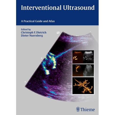 ISBN 9783131708212 product image for Interventional Ultrasound : A Practical Guide and Atlas (Hardcover) | upcitemdb.com