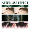 thumbnail image 4 of Productos para el cuidado del cabello Champú antipicazón Hair Moss Limpieza del cuero cabelludo Anticaspa Control de grasa capilar Antipicazón Refrescante Reparación 100 ml un champú, 4 of 5