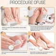 thumbnail image 5 of Automatic Callus Remover for Feet,Rechargeable Pedicure Tools for Feet, Electric Foot Callus Remover with 3 Roller Heads, 5 of 5