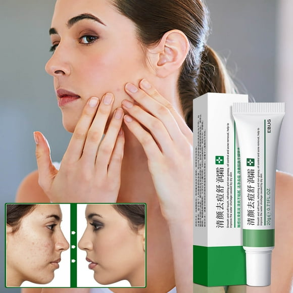 TopLLC Clear Face And-relieving Cream Fade Marks Water And Oil Removing Cream 20g a Cream
