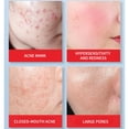thumbnail image 3 of Regalos de crema de manos, regalos para el Día de la Madre para mamá, loción de manos con ácido salicílico, crema reductora de poros, crema reductora de poros con ácido salicílico, 30 ml., 3 of 5
