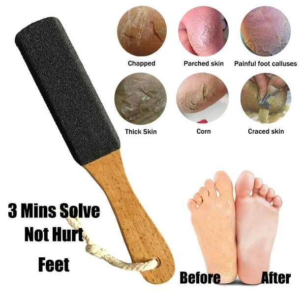 Dry foot scrubber sale