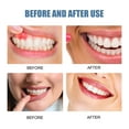 thumbnail image 2 of Gum Repair Spray Fire Relief Oral Cleaning 20ml, 2 of 5
