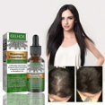 thumbnail image 1 of Hair Oil 30ml, 1 of 5