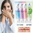 Probiotic Tongue Cleaning Gel Set, OralHygiene Brush & Tongue