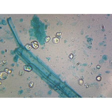 Slide  Anabaena; Blue-green Algae; Filamentous Cyanobacteria; Shows Heterocysts & Spores; Whole-mount price history on PriceWatchPro