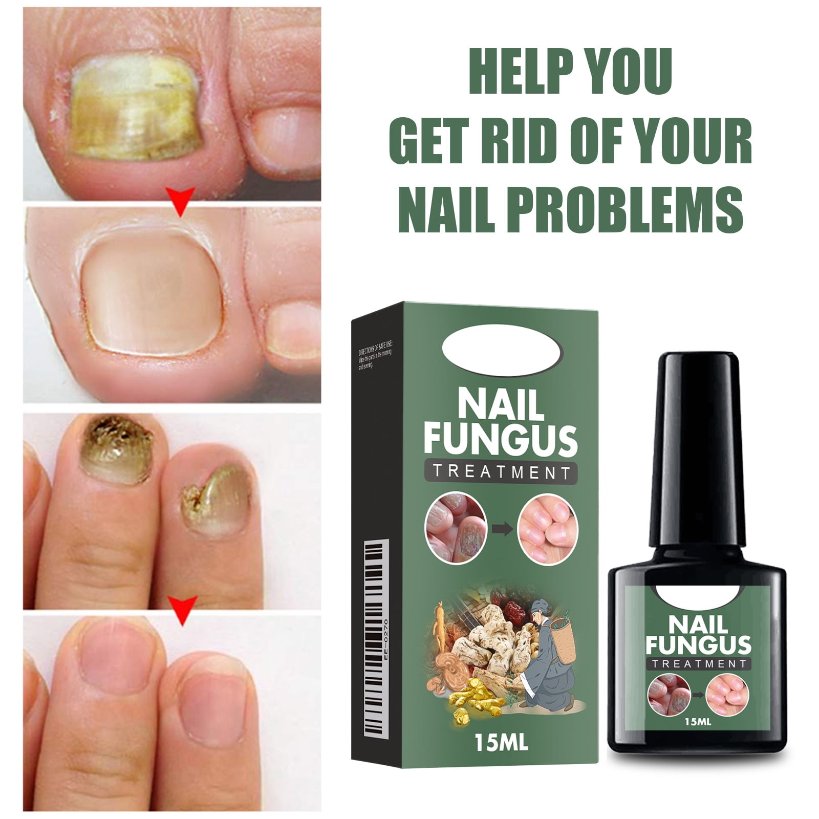 Alvantor Nail Fungus Treatment Solution for Thickened and Softened Damaged Nails, 0.5fl oz
