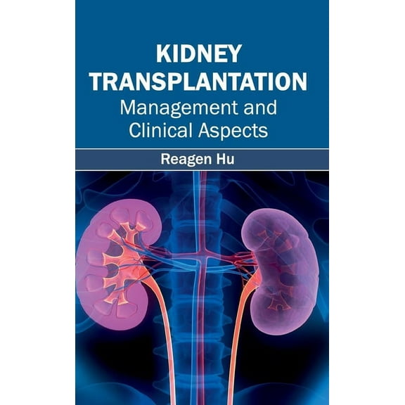 Kidney Transplantation: Management and Clinical Aspects, (Hardcover)