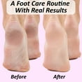 thumbnail image 3 of Extra Large Collapsible Foot Bath Soaking Basin Tub: Foot Spa Bucket, Pedicure Foot Spa Products, Soaker Bowl, The Foot Medic, Pink, 3 of 5