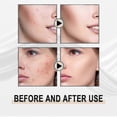 thumbnail image 5 of Líquido con ácido lactobiónico, exfoliante suave, limpieza profunda, puntos negros -4100715360034, 5 of 5