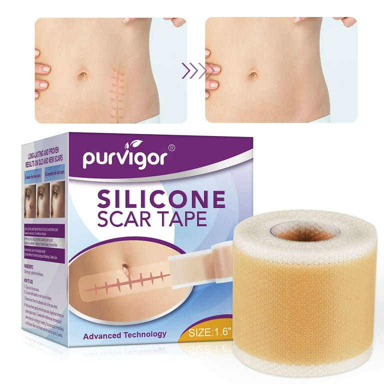 Purvigor Silicone Scar Tape Roll, 1.6” x 120” Medical Tape for Wound Care  Bandages Scars Strips for Surgical 