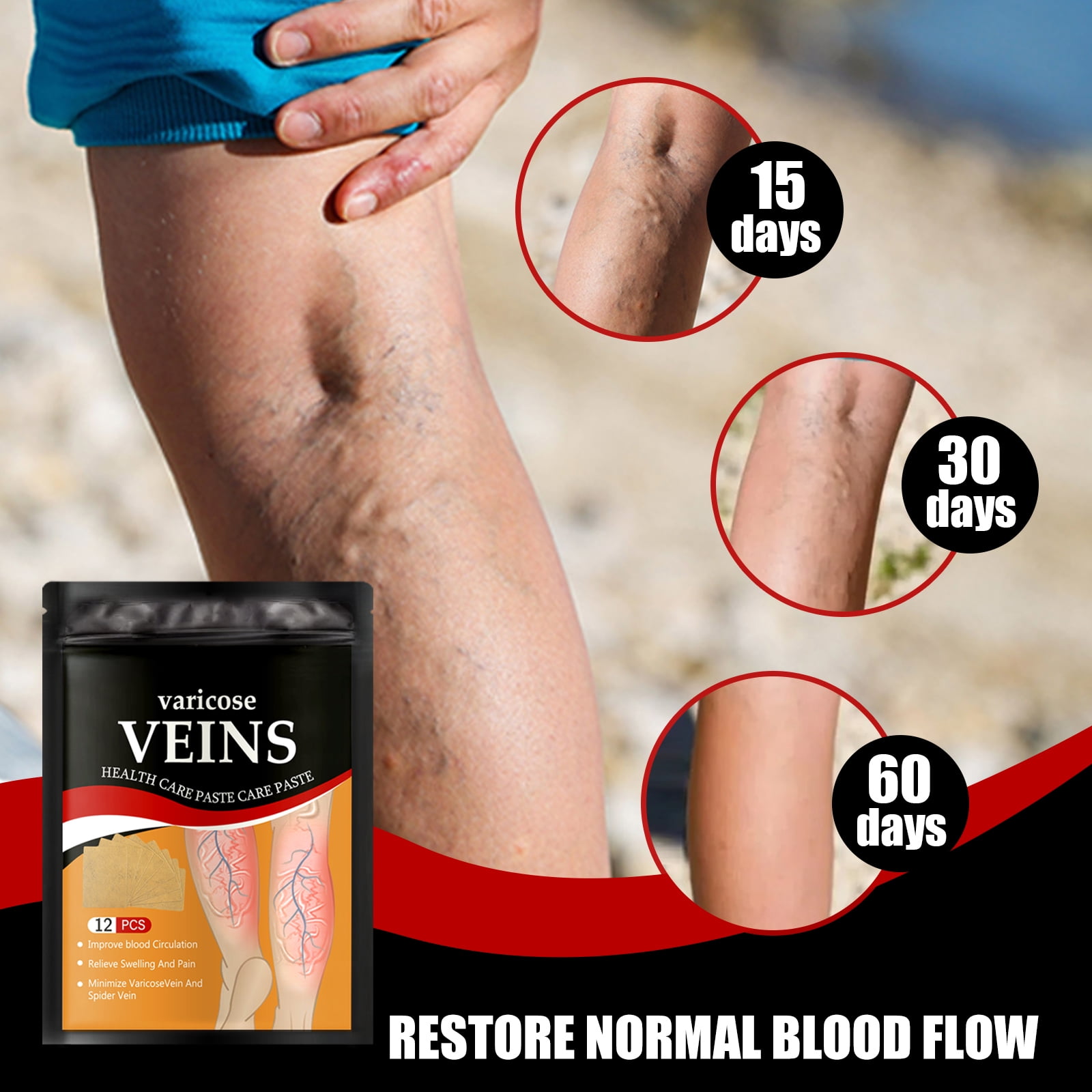 Alvantor Leg Relief Patches for Varicose & Spider Veins Treatment, 12 Pack