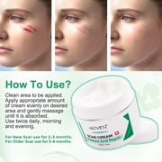 ALIVER Scar Cream, Stretch Marks Remover, Ideal for Acne, C-Section, Burns, Surgical Scars Treatment, Effective for Old and New Scars, 1.7 oz