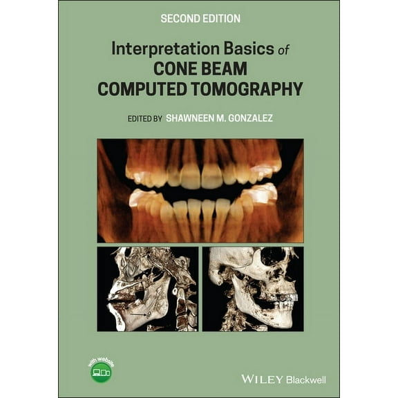 Interpretation Basics of Cone Beam Computed Tomography (Hardcover)