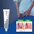 thumbnail image 3 of Dibucaine 1% Ointment 2 Oz. (56 gm) Hemorrhoidal Ointment Pack of 1, 3 of 8
