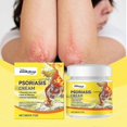 thumbnail image 1 of Psoriasis Cream, Skin Relief Anti-itch Cream Psoriasis Cream, Safe & Effective, Natural Herbal Skin Soothing Cream, 1 of 4