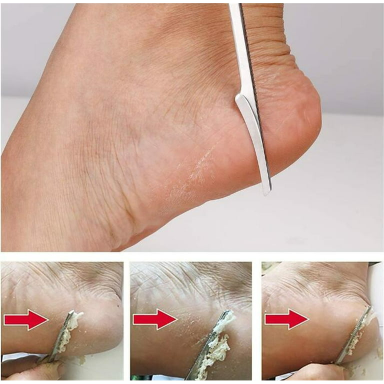 Colossal Foot Rasp & Wood Handle Callus Shaver (10 Replacement & 1 Foot  File Heads), Pedicure Foot File Kit, Heel Scraper For Feet, Foot File Callus  Remover