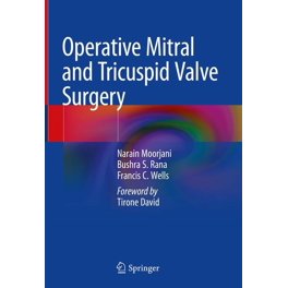 カーペンティアReconstructive valve surgery Carpentier's Reconstructive Valve Surgery: From Valve Analysis to