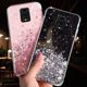 thumbnail image 1 of Xiaomi Redmi Note 9S 9 Pro Max Funda Glitter Bling ShinyTransparent Soft Phone Cover BY, 1 of 4