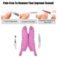 thumbnail image 5 of Unique Bargains Toenail Clippers for Thick Nails Sharp Nail Clippers Toenail Clippers Kits Stainless Steel Pink, 5 of 7