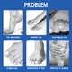 thumbnail image 3 of Férula del Dedo del Pie, Protección para Evitar la fricciónica del Martillo de los Pies para Las Mujeres para Los LOS Dedos Dañados, 3 of 7