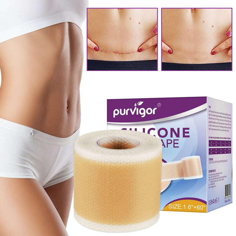 Purvigor Silicone Scar Tape Roll, 1.6” x 120” Medical Tape for Wound Care  Bandages Scars Strips for Surgical 