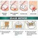 thumbnail image 2 of Toe Ingrown Nail Correction Patch Pedicure Tool, 2 of 3