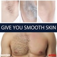 thumbnail image 5 of Crema depilatoria para hombres Qian Depilación del pecho Depilación de las axilas Depilación suave de las piernas Depilación corporal completa para hombres Depilación suave | 83, 5 of 5